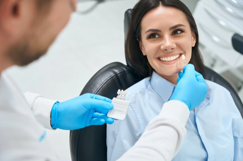 Veneers placement